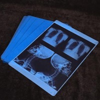 High Quality PET Blue Inkjet Medical X-Ray Film